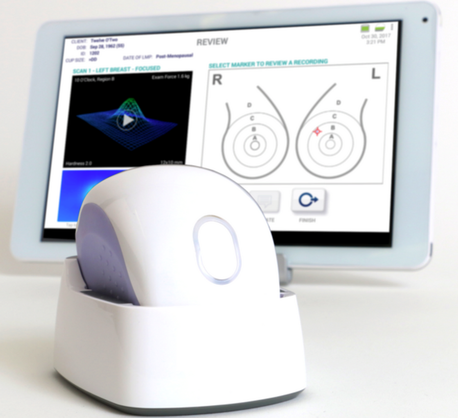 Revolutionizing Breast Cancer Detection with BEXA AI
